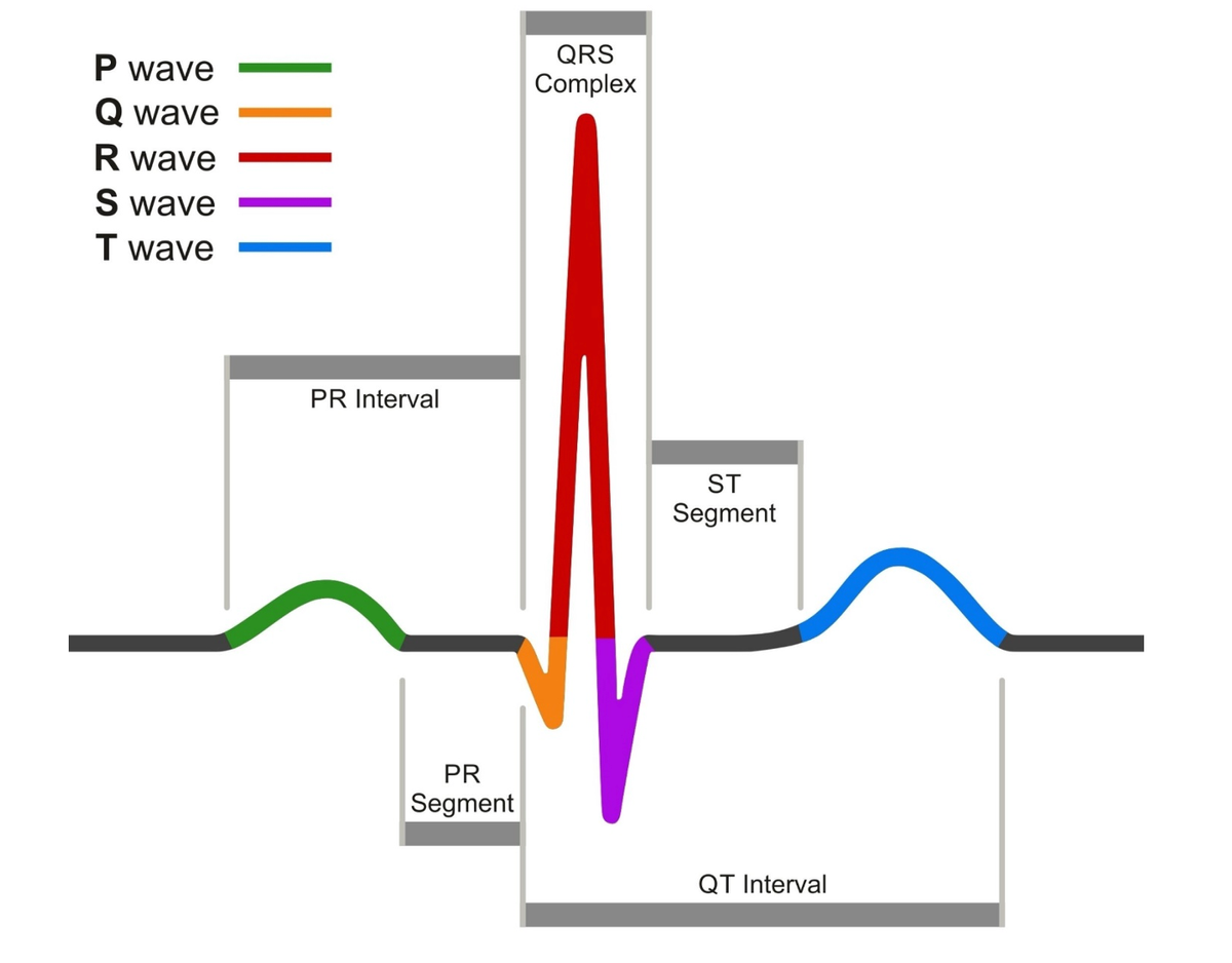 ECG Quiz: Interpreting Cardiac Waveforms